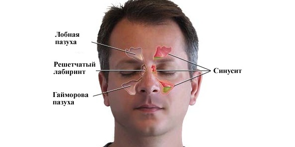 Расспростронение болезни