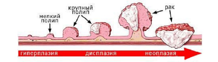 Перерождение полипов