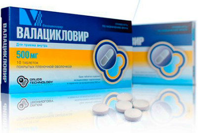 валацикловир