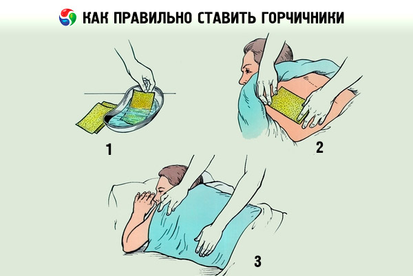 Горчичники при бронхите