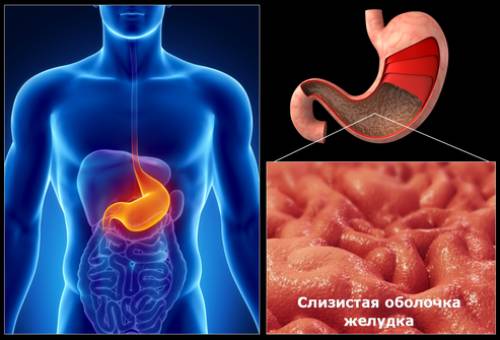 Диагноз дуоденит diagnoz-duodenit