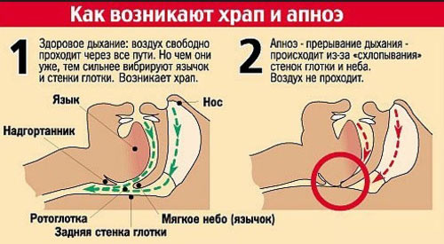 Храп hrap