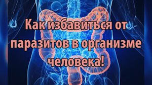 Как избавиться от паразитов в организме человека в домашних условиях Как в домашних условиях избавиться от паразитов в организме человека