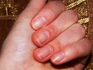 Как укрепить ногти после гель-лака в домашних условиях kak-ukrepit-nogti-posle-gel-laka-v-domashnih-usloviyah