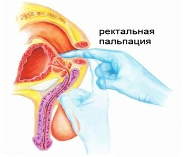 Массаж простаты пальцем техника выполнения massazh-prostaty-palcem-tekhnika-vypolneniya