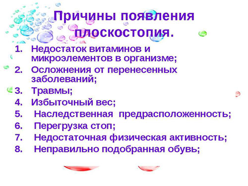 Причины плоскостопия prichiny-ploskostopiya