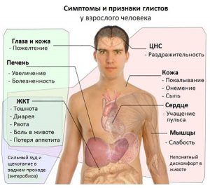 Признаки наличия паразитов в организме человека Признаки в организме человека наличия паразитов